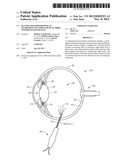 ILLUMINATED MICROSURGICAL INSTRUMENT INCLUDING OPTICAL FIBER WITH BEVELED     END FACE diagram and image