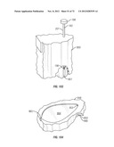 Tissue penetration device diagram and image