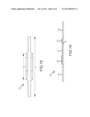 SENSOR ASSEMBLY TETHERED WITHIN CATHETER WALL diagram and image