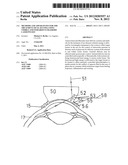 Methods and Apparatuses for the Treatment of Glaucoma using visible and     infrared ultrashort laser pulses diagram and image