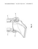 Hinged Equinus Brace With Pediatric, Diabetic and Clubfoot Versions diagram and image