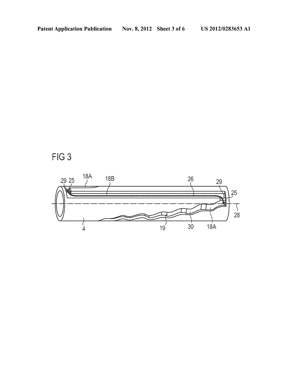 Assembly for a Drug Delivery Device - diagram, schematic, and image 04