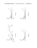 SUTURE PASSER DEVICES AND METHODS diagram and image