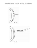 SUTURE PASSER DEVICES AND METHODS diagram and image