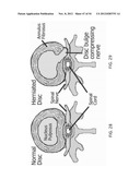 SUTURE PASSER DEVICES AND METHODS diagram and image