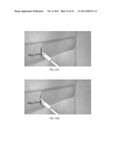 SUTURE PASSER DEVICES AND METHODS diagram and image