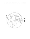 METHODS AND APPARATUS FOR CROSSING OCCLUSIONS IN BLOOD VESSELS diagram and image