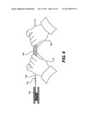 METHODS AND APPARATUS FOR CROSSING OCCLUSIONS IN BLOOD VESSELS diagram and image