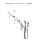 COMPRESSIBLE ARTERIOTOMY LOCATOR FOR VASCULAR CLOSURE DEVICES AND METHODS diagram and image