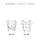 PATIENT-WORN ENERGY DELIVERY APPARATUS AND TECHNIQUES FOR SIZING SAME diagram and image