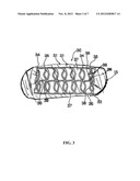 HELICAL HYBRID STENT diagram and image