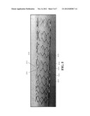 HELICAL HYBRID STENT diagram and image