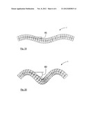 MEDICAL DEVICE SUITABLE FOR LOCATION IN A BODY LUMEN diagram and image