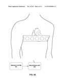 ASSESSING INTRA-CARDIAC ACTIVATION PATTERNS diagram and image