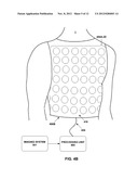 ASSESSING INTRA-CARDIAC ACTIVATION PATTERNS diagram and image