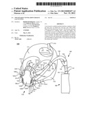 NON-INVASIVE VENTILATION EXHAUST GAS VENTING diagram and image