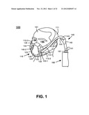 NON-INVASIVE VENTILATION EXHAUST GAS VENTING diagram and image