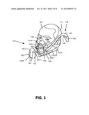 NON-INVASIVE VENTILATION EXHAUST GAS VENTING diagram and image