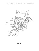 NON-INVASIVE VENTILATION EXHAUST GAS VENTING diagram and image