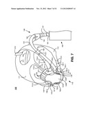 NON-INVASIVE VENTILATION EXHAUST GAS VENTING diagram and image