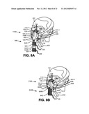 NON-INVASIVE VENTILATION EXHAUST GAS VENTING diagram and image