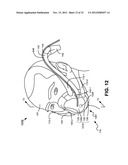 NON-INVASIVE VENTILATION EXHAUST GAS VENTING diagram and image