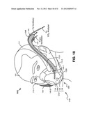 NON-INVASIVE VENTILATION EXHAUST GAS VENTING diagram and image