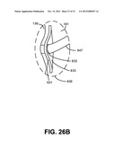 NON-INVASIVE VENTILATION EXHAUST GAS VENTING diagram and image