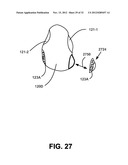 NON-INVASIVE VENTILATION EXHAUST GAS VENTING diagram and image