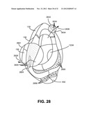 NON-INVASIVE VENTILATION EXHAUST GAS VENTING diagram and image