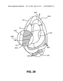 NON-INVASIVE VENTILATION EXHAUST GAS VENTING diagram and image