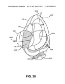 NON-INVASIVE VENTILATION EXHAUST GAS VENTING diagram and image