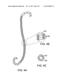 METHODS OF MANUFACTURING LINEARLY EXPANDABLE URETERAL STENTS diagram and image