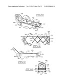 Guard Bar and Tunable Footpeg System for All-Terrain Vehicles diagram and image