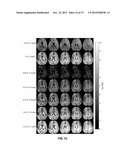 Magnetic Resonance Methodology for Imaging of Exchange-Relayed     Intramolecular Nuclear Overhauser Enhancement Effects in Mobile Solutes diagram and image