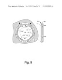 CENTERING MECHANISMS FOR TURBOCHARGER BEARINGS diagram and image