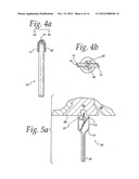 Damaged Bolt and Screw Removing Devices diagram and image