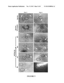 Interpenetrating polymer network comprising fibrin diagram and image