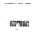 Interpenetrating polymer network comprising fibrin diagram and image