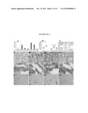 Lipase Inhibitors for the Treatment of Pancreatitis and Organ Failure diagram and image