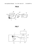 Endoscope diagram and image