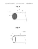 Endoscope diagram and image