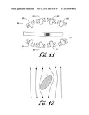 INTRALUMEN MEDICAL DELIVERY VESSEL PROPELLED BY SUPERCONDUCTIVE     REPULSION-LEVITATION MAGNETIC FIELDS diagram and image