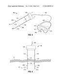 TWIN CAMERA ENDOSCOPE diagram and image