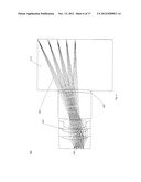 Acoustic Imaging Probe Incorporating Photoacoustic Excitation diagram and image