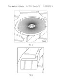Implantable Intraocular Pressure Drain diagram and image