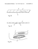 WOUND SHIELD diagram and image