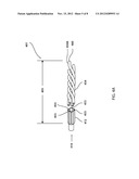 COILED HEAT EXCHANGER FOR CRYOSURGICAL INSTRUMENT diagram and image