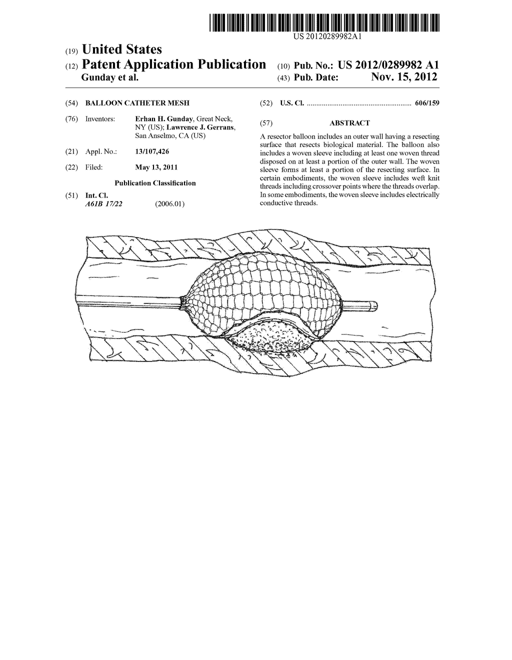 Balloon Catheter Mesh - diagram, schematic, and image 01