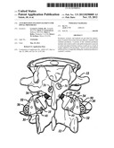 Anti-Rotation Fixation Element for Spinal Prostheses diagram and image